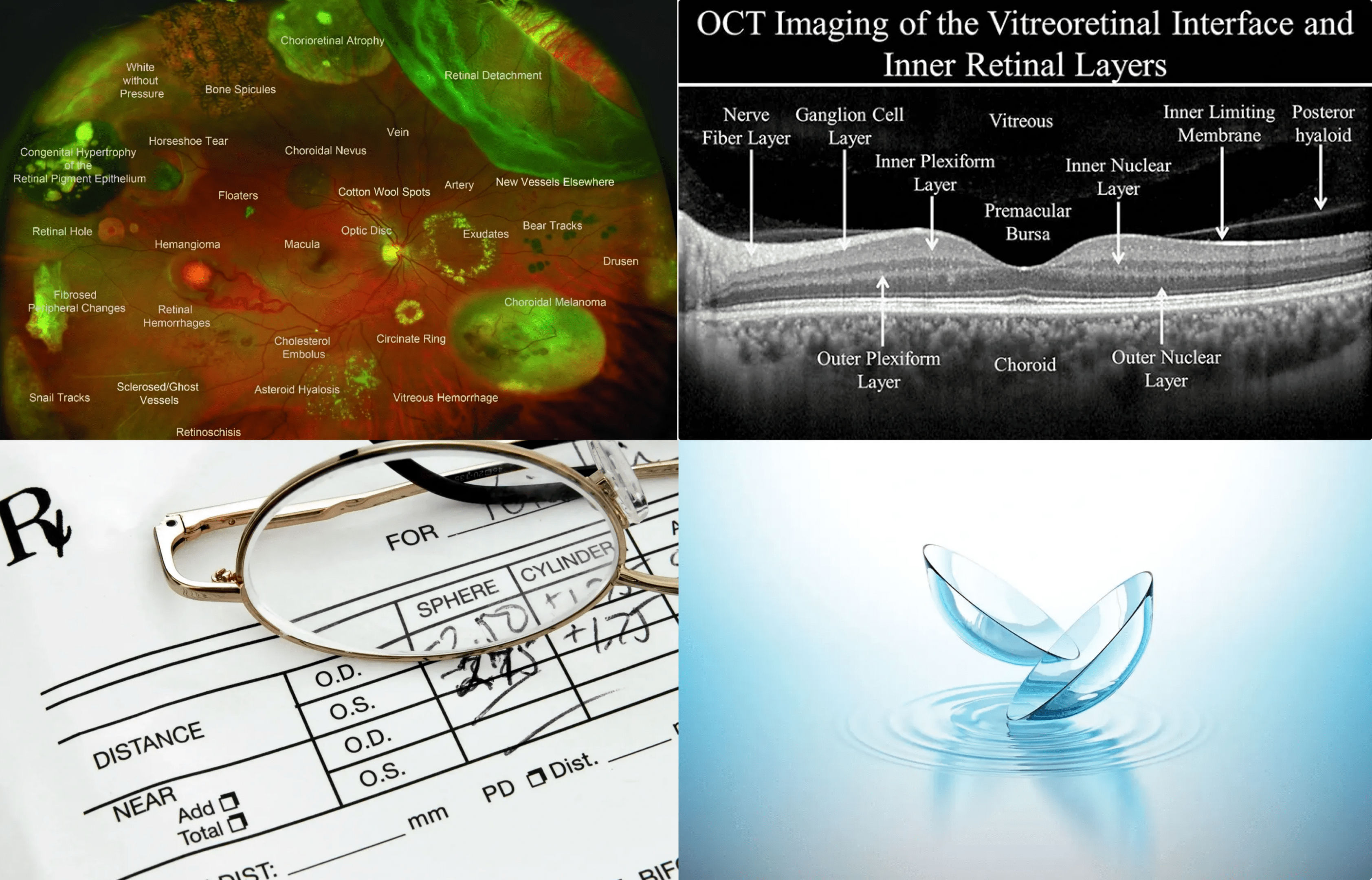 Microscopic and imaging techniques reveal detailed eye structure and molecular data.