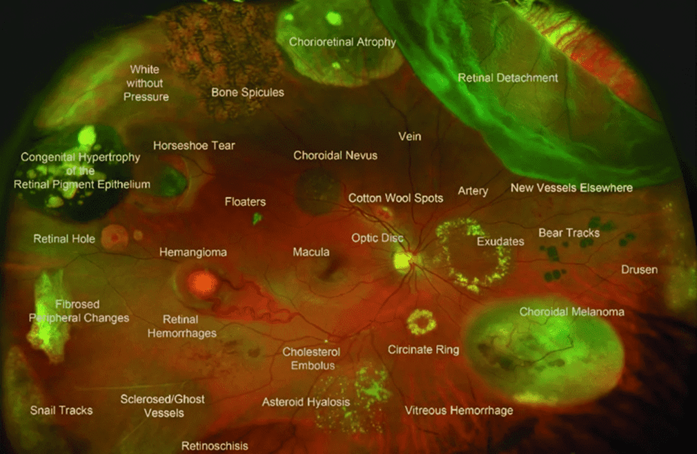 Fluorescent microscopy image showing labeled neurons and brain regions.