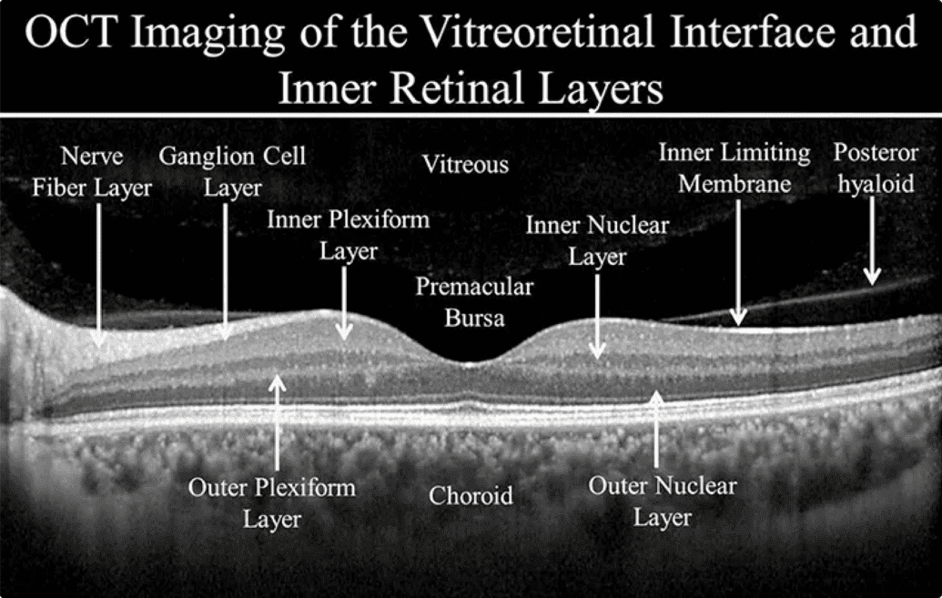 Cross-sectional image of the retina showing detailed inner layers and cells.